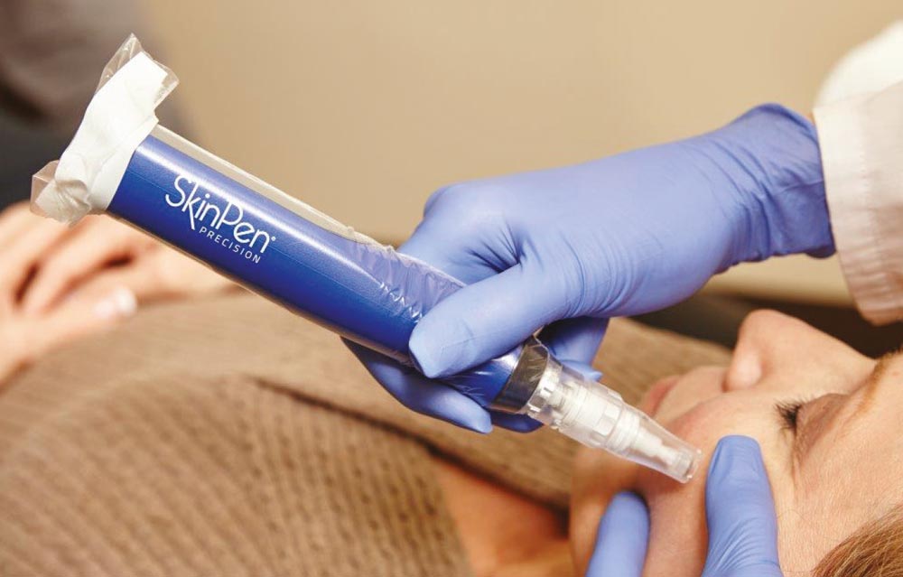 microneedling Skin Pen